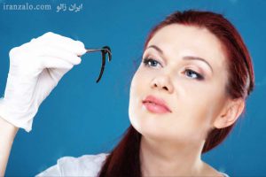 پرورش زالو چرا و چگونه؟ 2 الی 10 سانت 2 Leech Iranzalo (1)