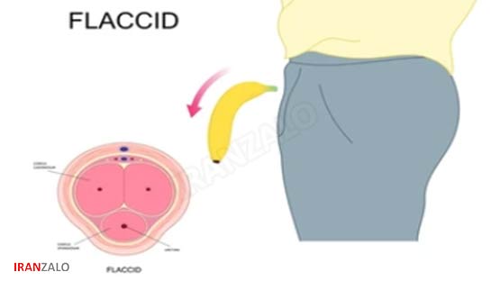 زود انزالی آقایان
زود انزالی از نظر طب سنتی
