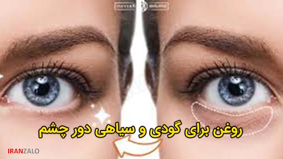 روغن برای گودی و سیاهی دور چشم 2